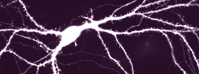 Pyramidal cell