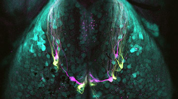 bulb magenta scan